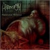 Anarkhon - Obesidade Mórbida 