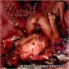 Vulvectomy - Putrescent Clitoral Fermentation