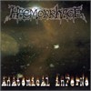 Haemorrage - Anatomical Inferno